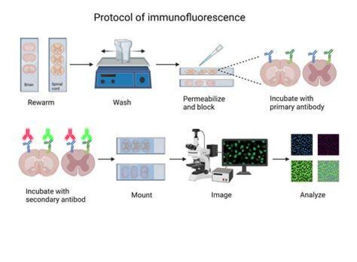 Does IHC accept select health?