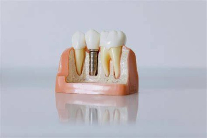 How long can you soak dentures in Polident?