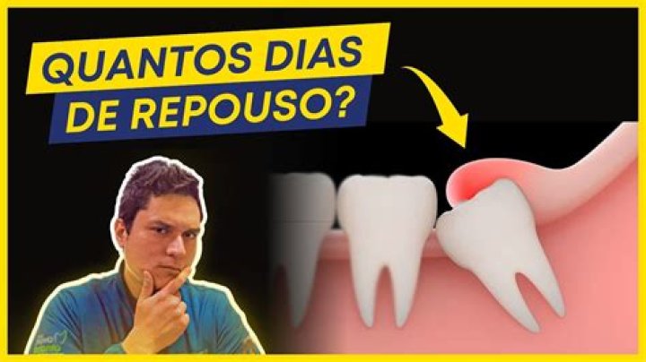 Quantos dias tem que ficar de repouso quando arranca dente?