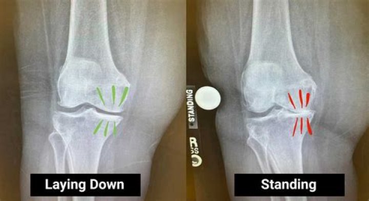 What can an xray show?
