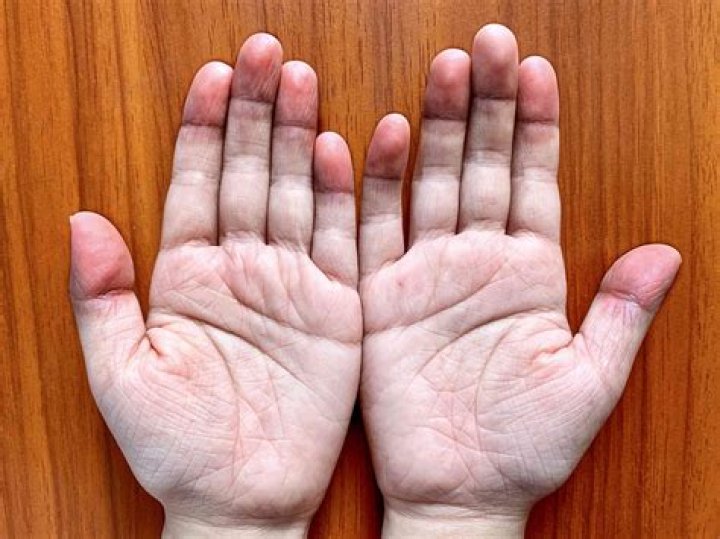 What does pale color look like?