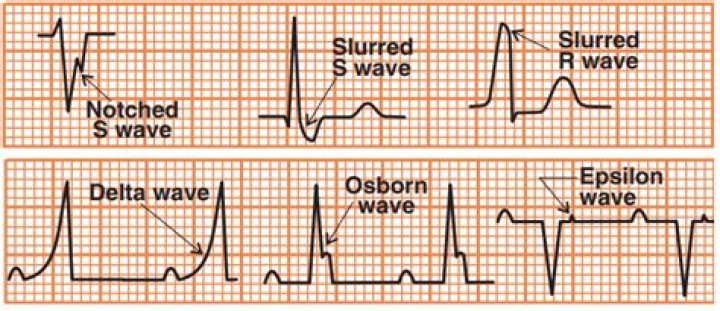 What does the S wave mean?
